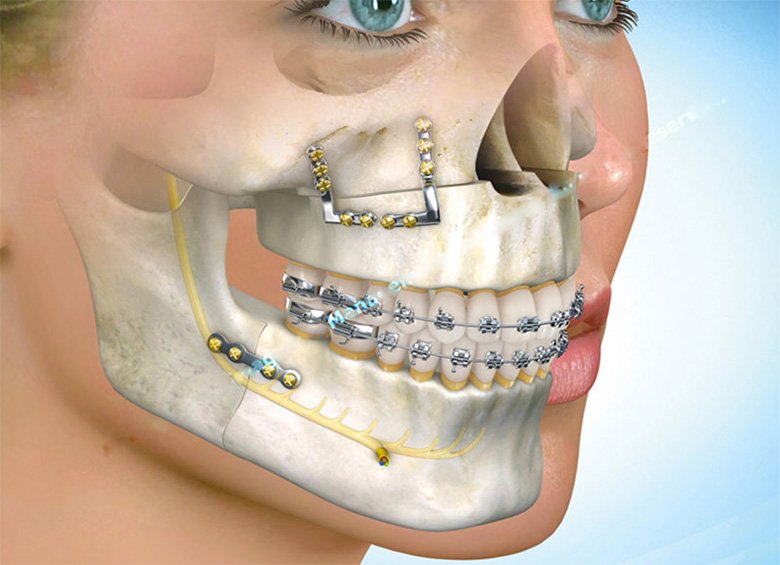 buco-maxilo-facial
